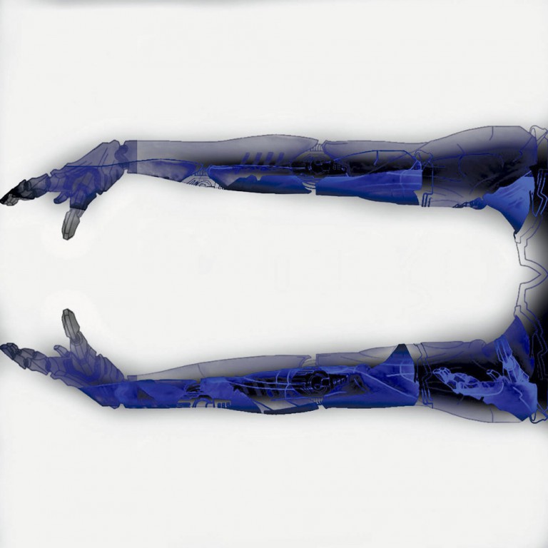 Researchers Develop Brain-Controlled Artificial Arm