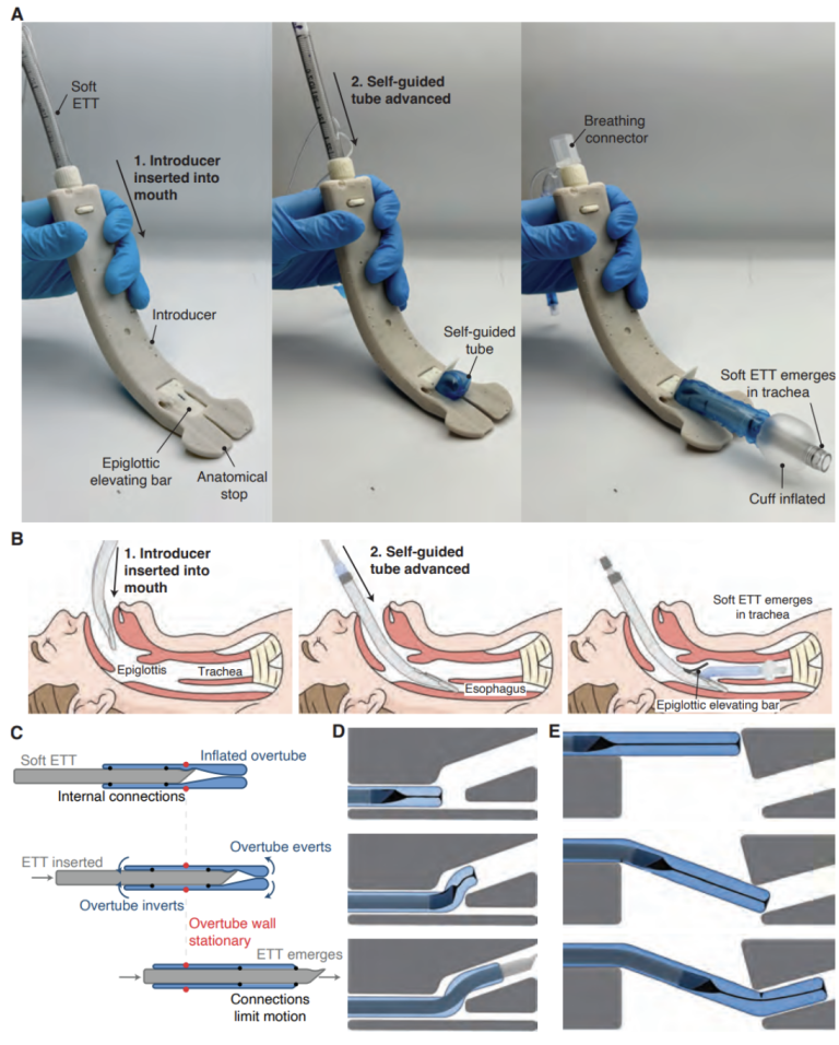 A Growing Vine in Medical Tech: The Soft Robot Saving Airways
